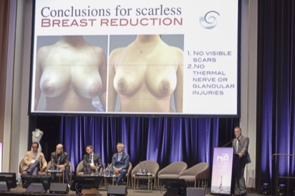 MIB Meeting 2025, minimally invasive breast surgery congress in Paris — photo 103